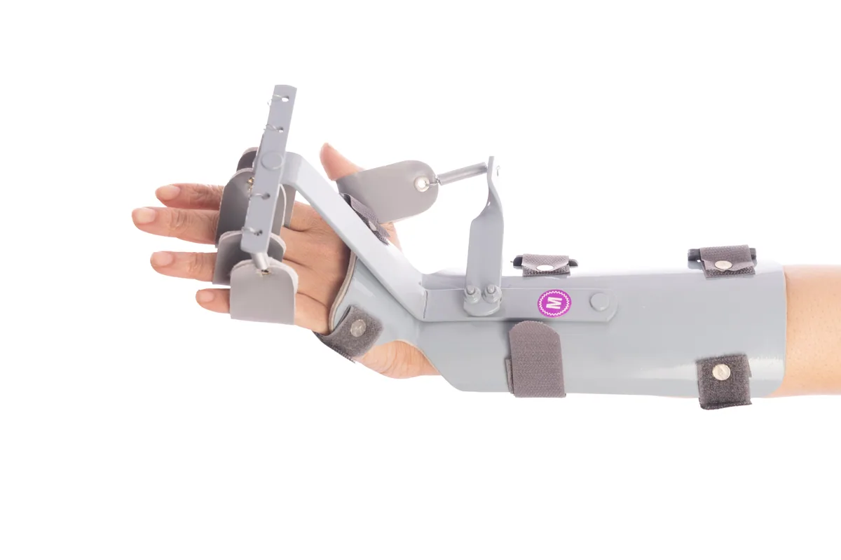 Dynamic Cock-Up Splint